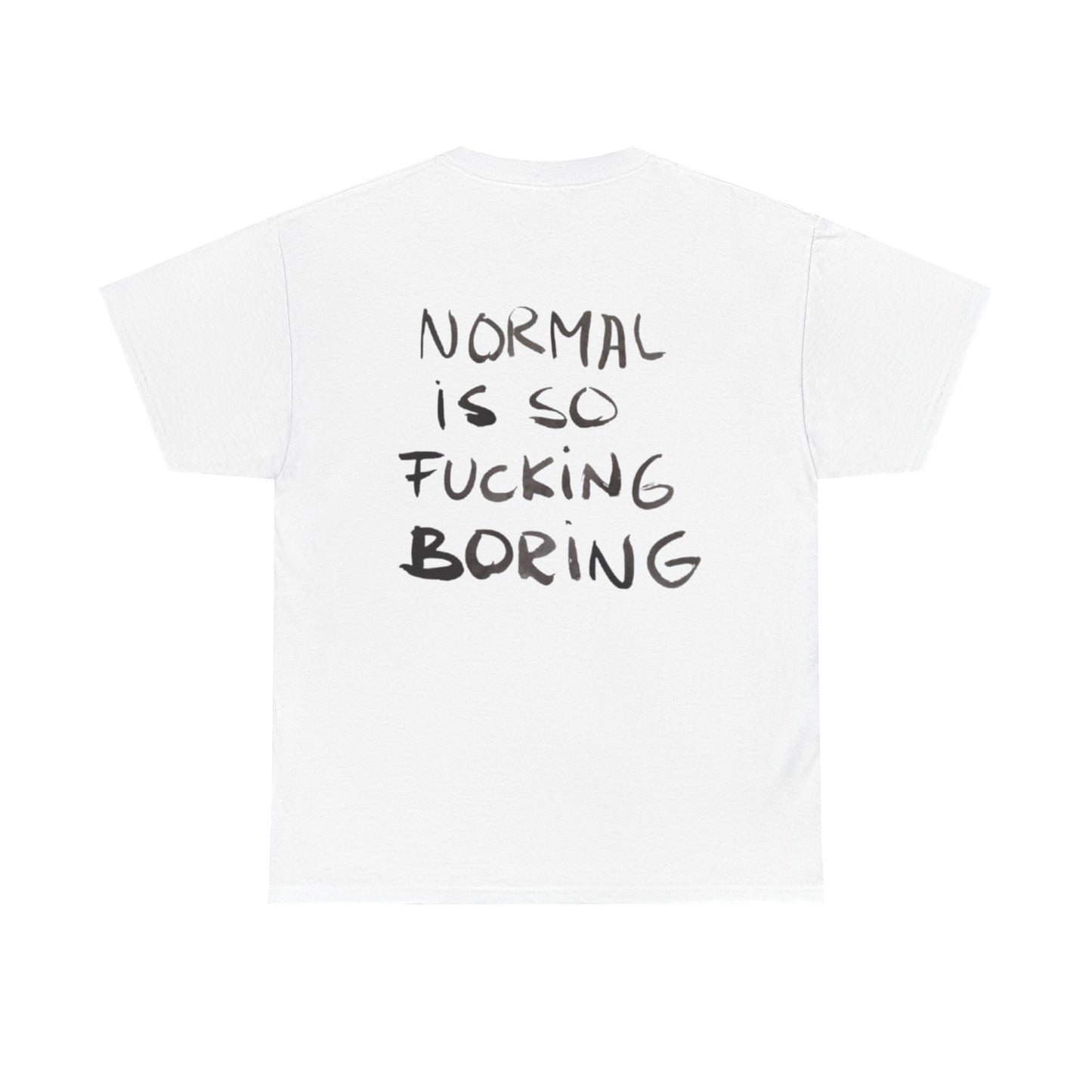 Normal Is Boring
